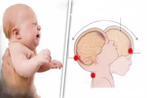 La Sindrome del bambino scosso